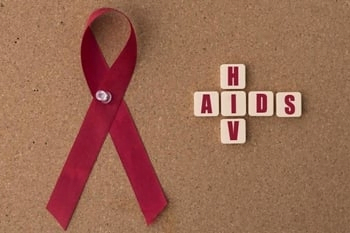 HIV Aids