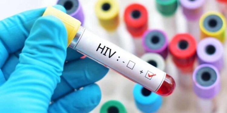 HIV AIDS