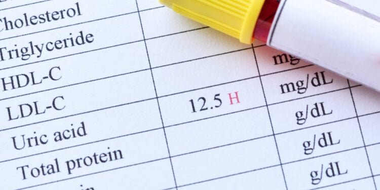 Uric Acid