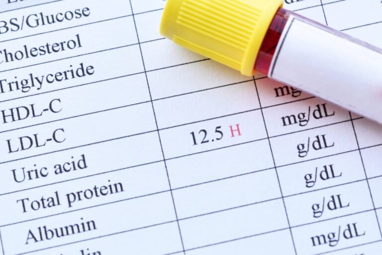 Uric Acid | International Khabar Uric Acid