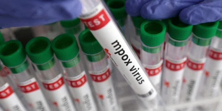 A 29yearold native of Ernakulam district in Kerala has been confirmed to have contracted Mpox infection according to the Kerala Health department | International Khabar A 29 year old native of Ernakulam district in Kerala has been confirmed to have contracted Mpox infection according to the Kerala Health department